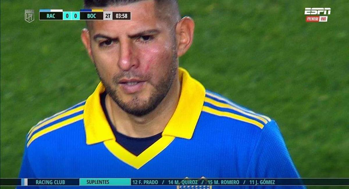 Carlos Zambrano mostró golpes en el rostro. Foto: Twitter Difusión