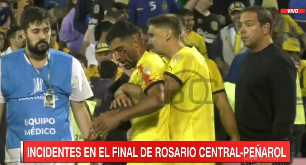 Futbolista de Peñarol fue agredido salvajemente. Foto: Captura de SportsCenter